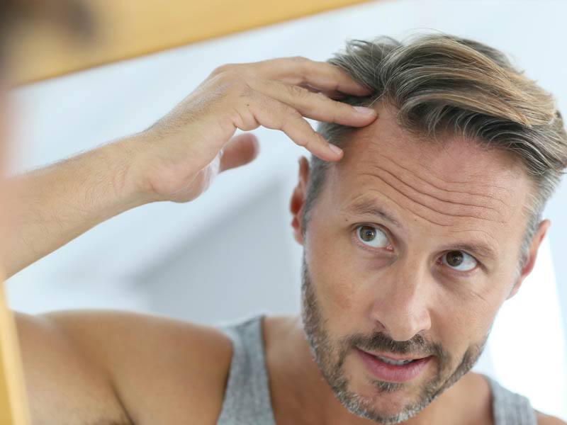 Causes Of Hair Loss The Toronto Hair Transplant Clinic 8223