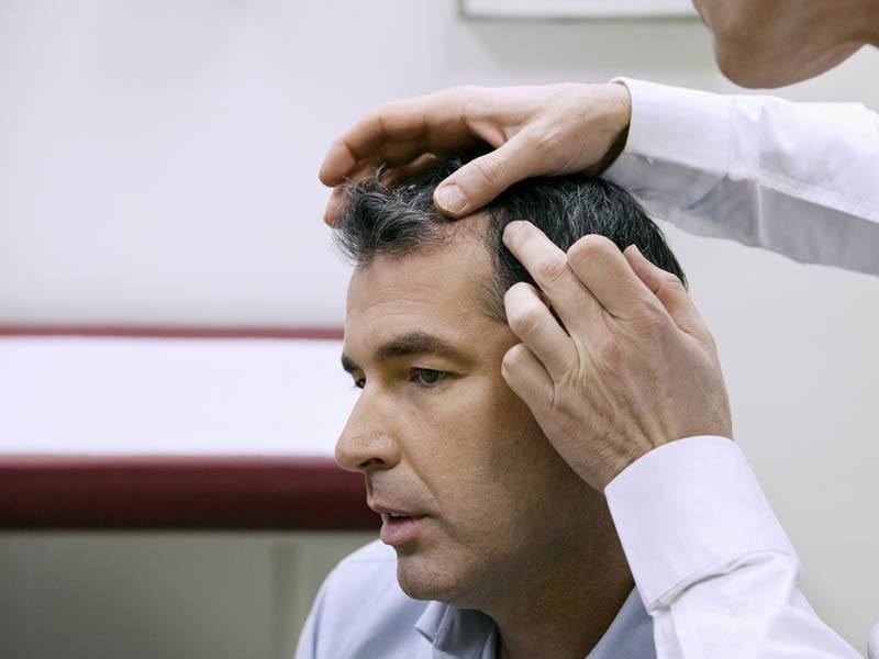 What Is The NeoGraft Process