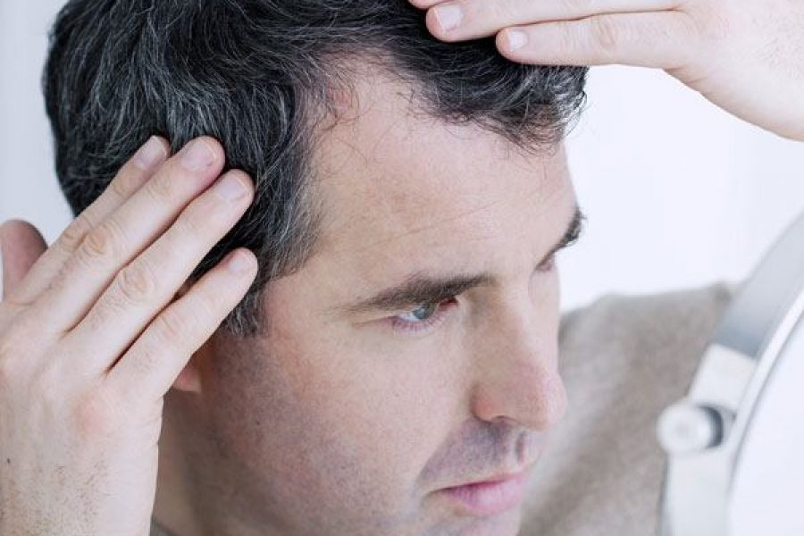 PRP Therapy For Hair Restoration