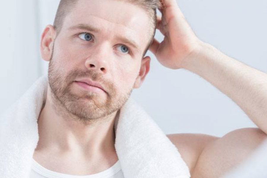 When Is The Right Time For A Hair Transplant?