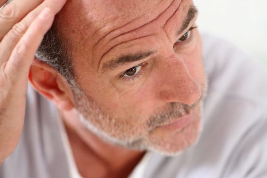 10 Other Causes For Hair Loss Besides Genetics