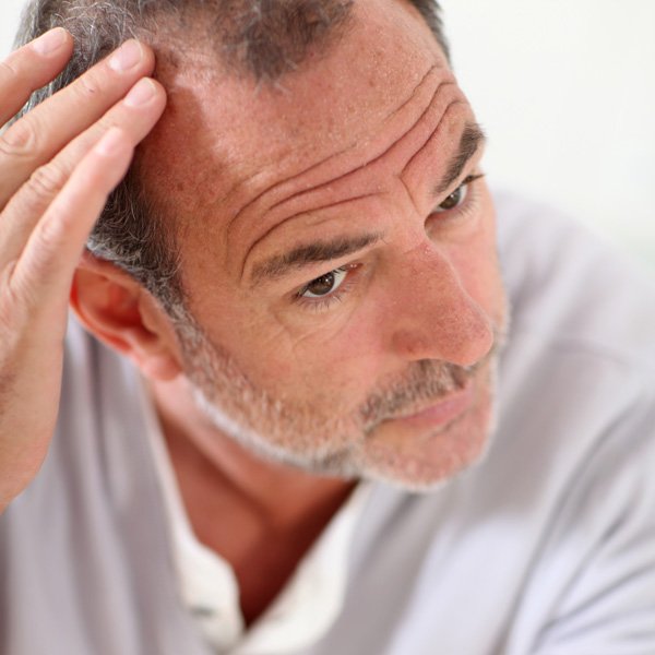 Causes For Hair Loss Causes For Hair Loss