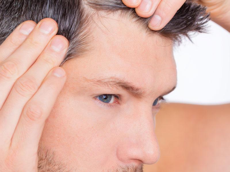 Hair Transplant Toronto Hair Transplant Toronto