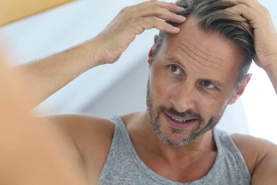 Shedding After A Hair Transplant In Toronto
