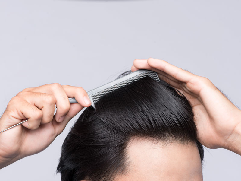 Remove Scalp Micropigmentation