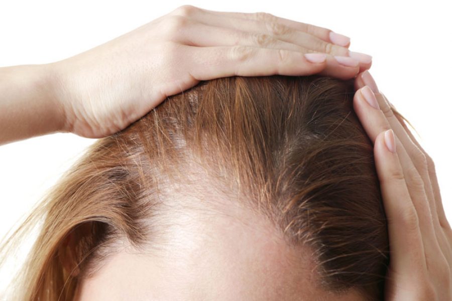 Hair Transplant Procedures To Avoid