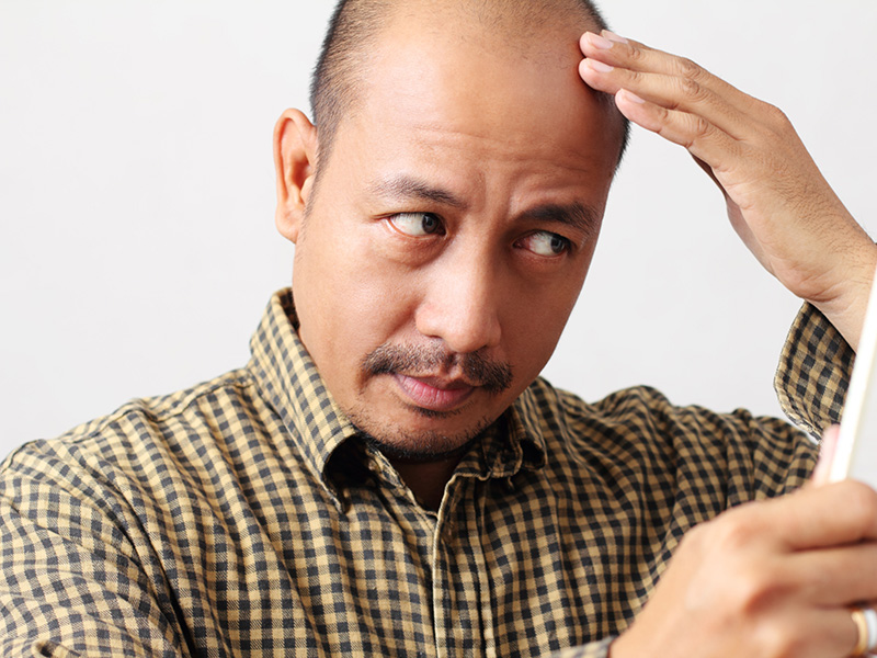Tried and Tested Tips to Control Hair Fall - Hair Restoration Toronto
