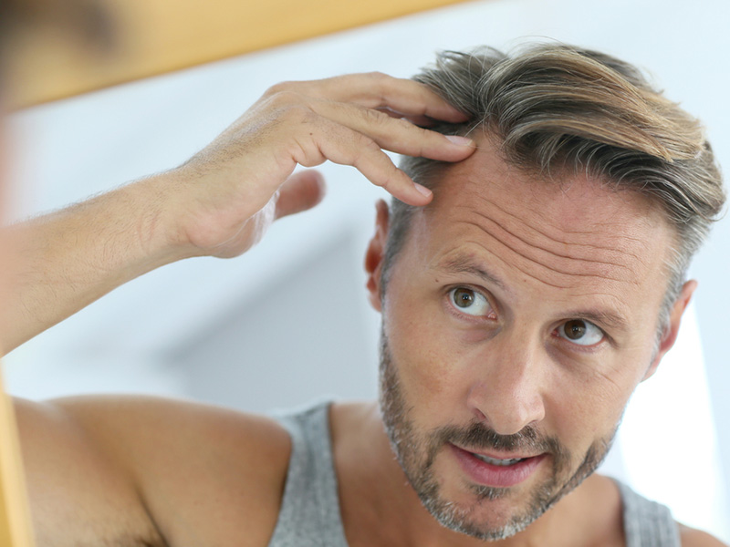 What to Expect After Each Hair Transplant Session - Hair Transplant Treatment Toronto