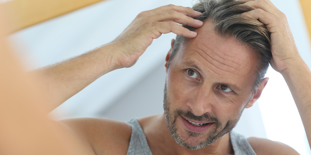 Hair Care And Styling After A Hair Transplant - Hair Transplant Toronto