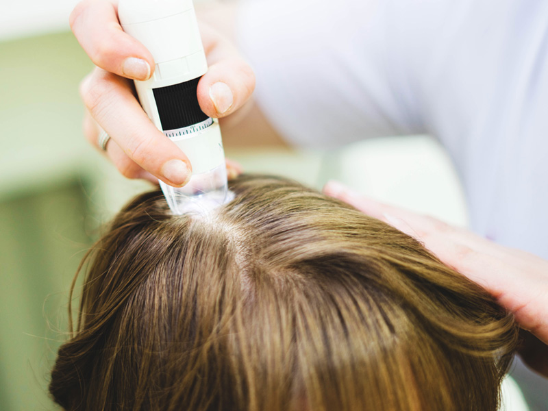 The Hairline is the Most Important Part of a Hair Transplant The Hairline is the Most Important Part of a Hair Transplant