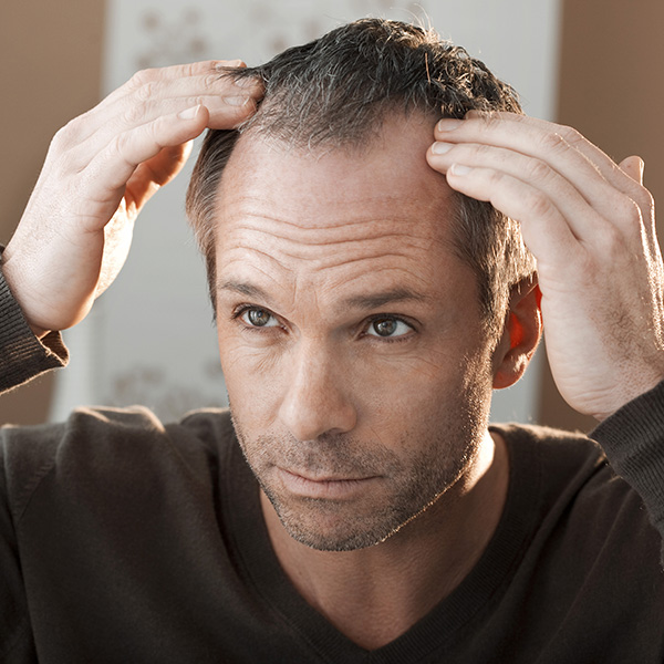 The Psychology of Male Hair Loss