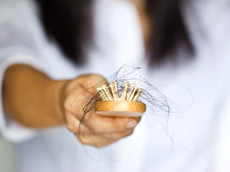 Hair Transplant Reversal