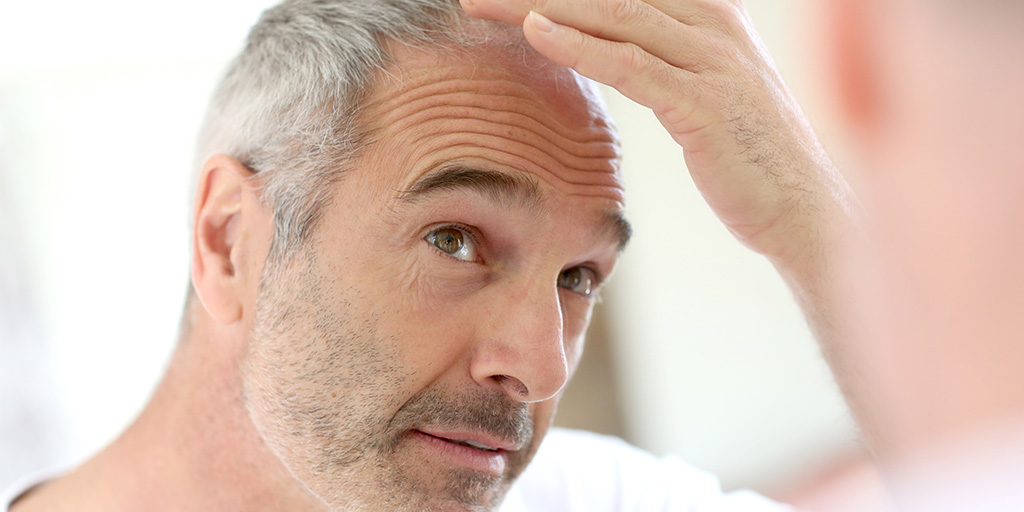 4 Ways You Know That You Are Ready To Get A Hair Transplant