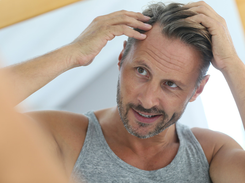 How To Take Care Of New Hair Grafts After Your Hair Transplant Treatment