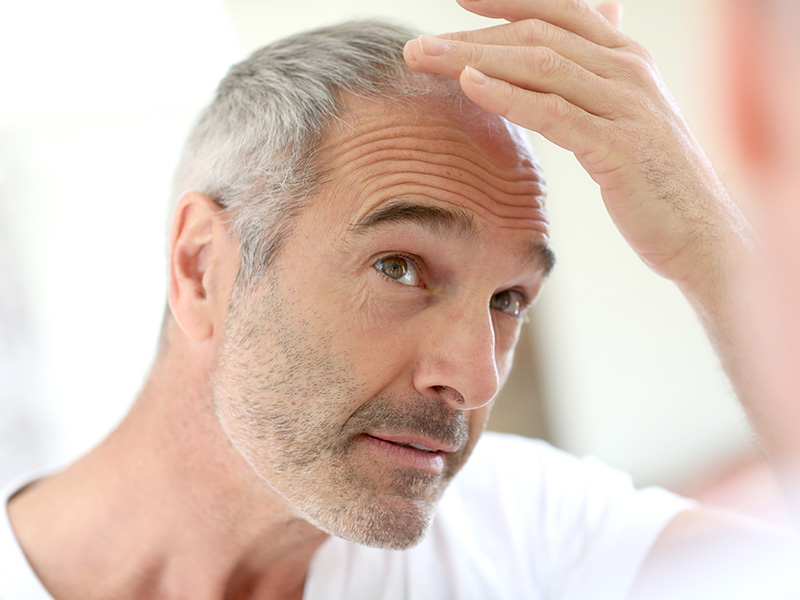 what-is-the-perfect-age-for-an-fue-hair-transplant-dr-torgerson