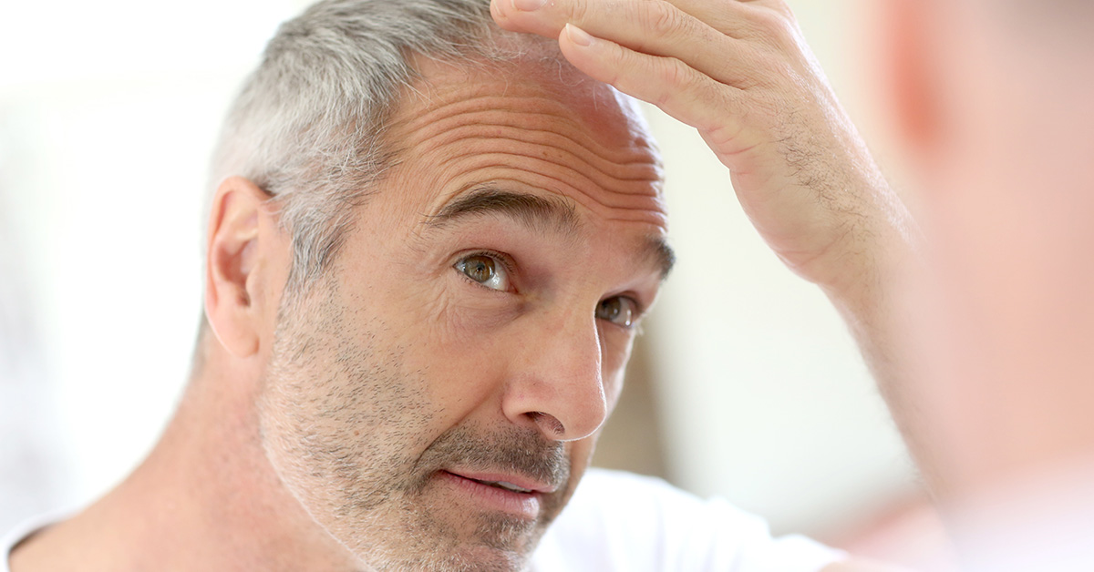 What Is The Perfect Age For An FUE Hair Transplant - Dr. Torgerson