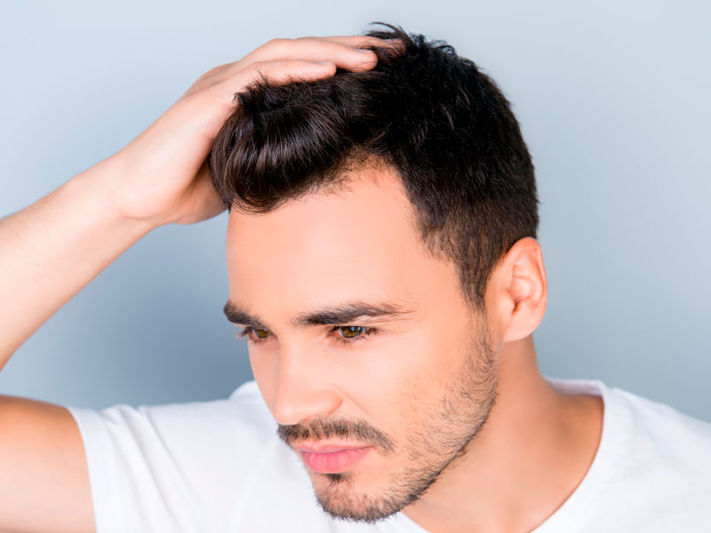 Toronto-Hair-Loss-Options—Have-You-Considered-Scalp-Micropigmentation