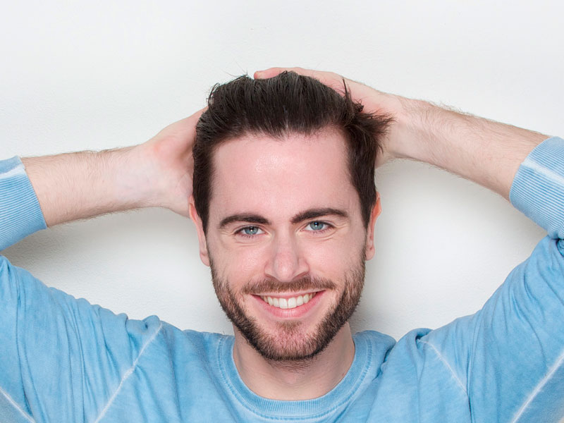 Shedding-after-an-FUE-hair-transplant