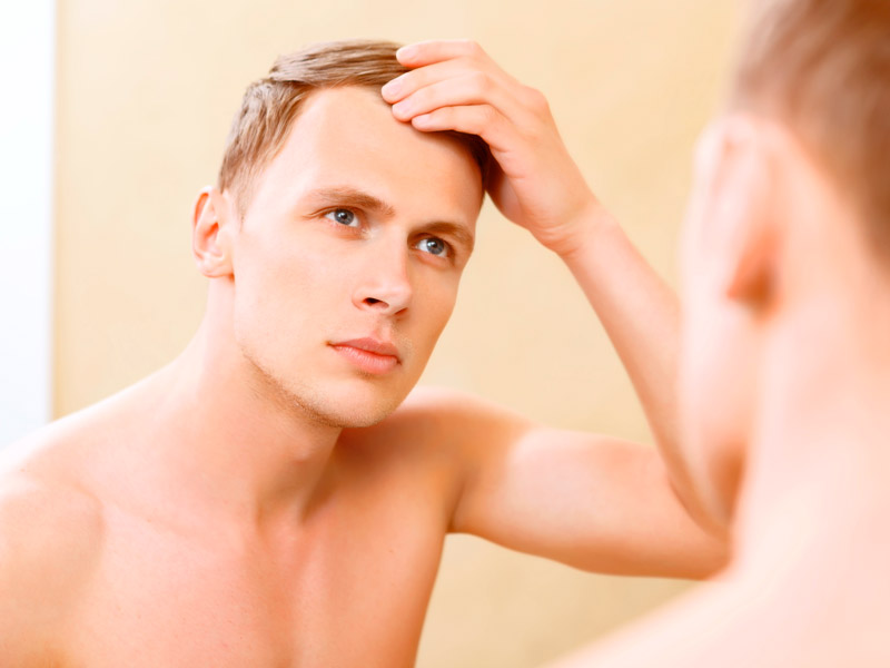 To young what balding do when Hair loss