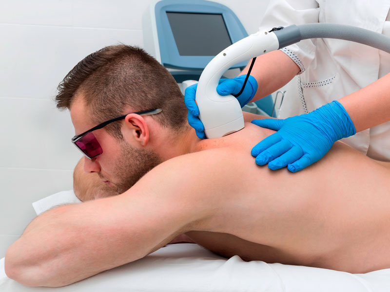 Laser-Hair-Removal-for-Male-Athletes-Toronto