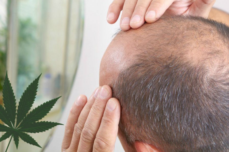 Marijuana Affects Hair Loss