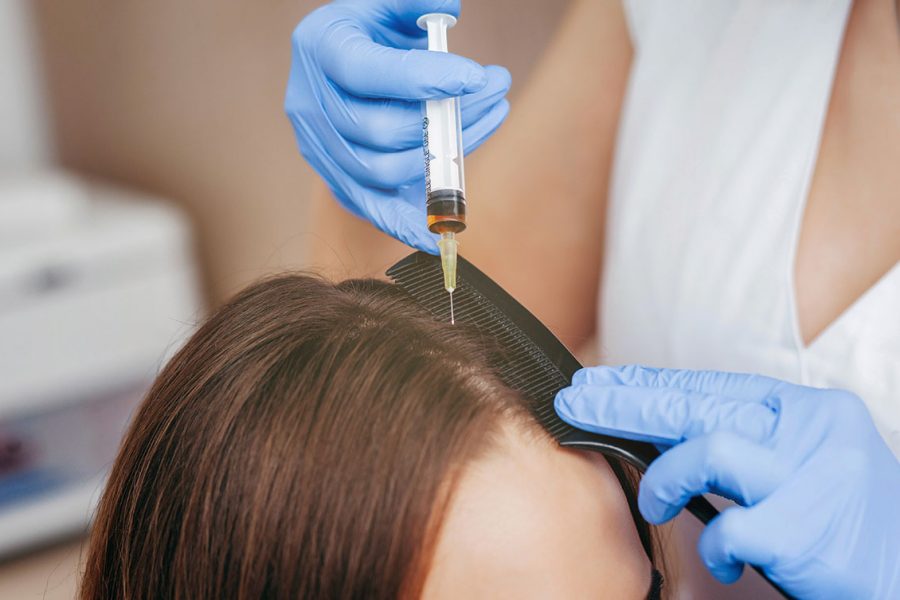 PRP for Hair: Here Are the Top 5 Reasons Why Patients and Doctors Are Taking a Closer Look