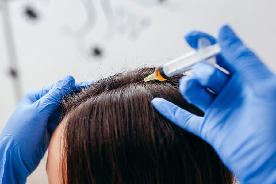 What Have Plastic Surgeons Discovered About PRP for Hair Loss? Hint: You Hold the Solution