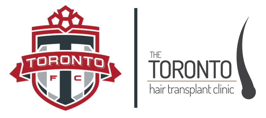 Toronto Hair Transplant Clinic