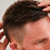 Lifestyle Factors That Quietly Accelerate Male Hair Loss
