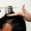 Thinning Crown Guide: Choose SMP, Transplant, or Both by Donor Supply