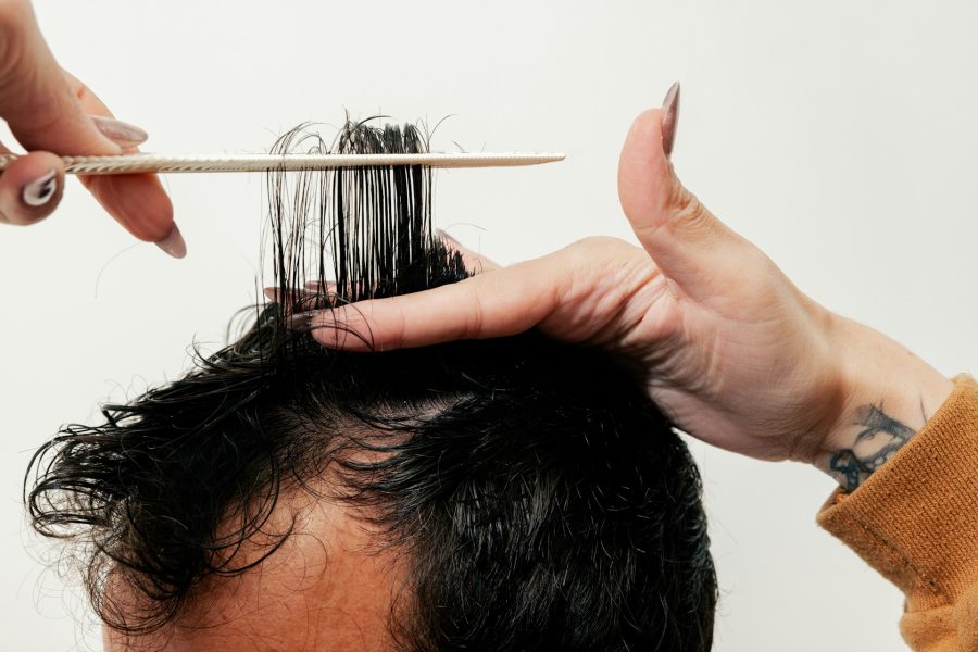 Thinning Crown Guide: Choose SMP, Transplant, or Both by Donor Supply