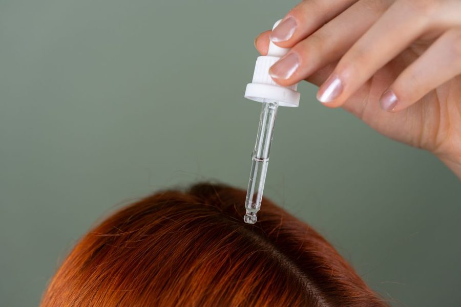 Beyond Transplants: Scalp Treatment Hair Growth Strategies That Help
