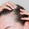 How to Read Hair Loss Labs Before Stem Cell Therapy vs PRP vs Transplant