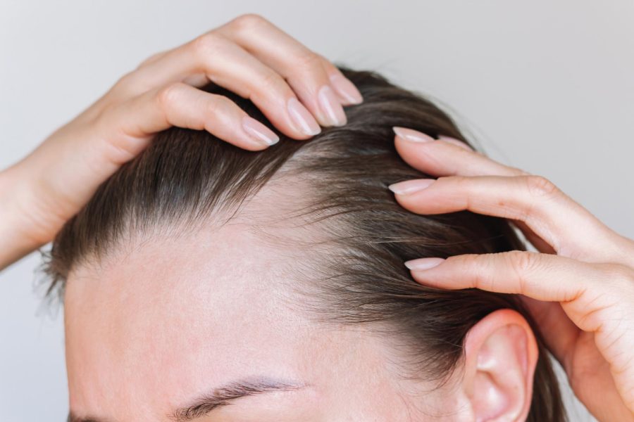 How to Read Hair Loss Labs Before Stem Cell Therapy vs PRP vs Transplant