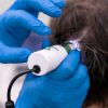 Questioning Exosome Hair Treatment Claims for Hair Loss