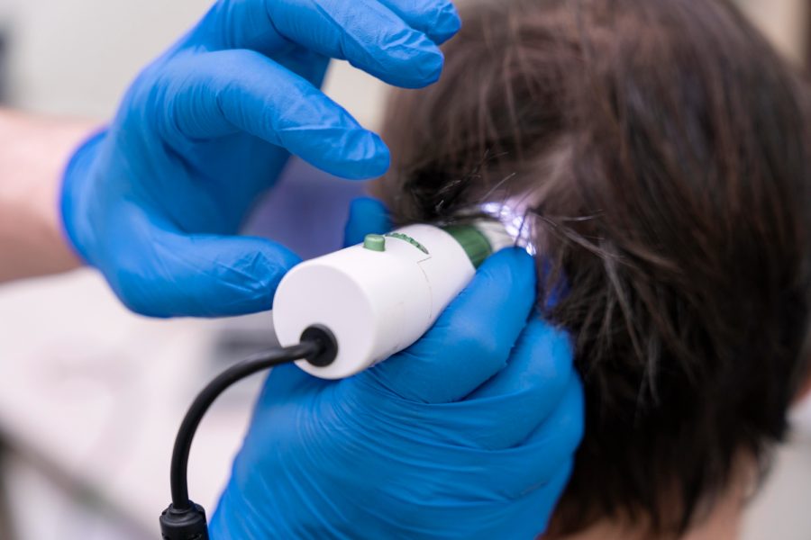 Questioning Exosome Hair Treatment Claims for Hair Loss