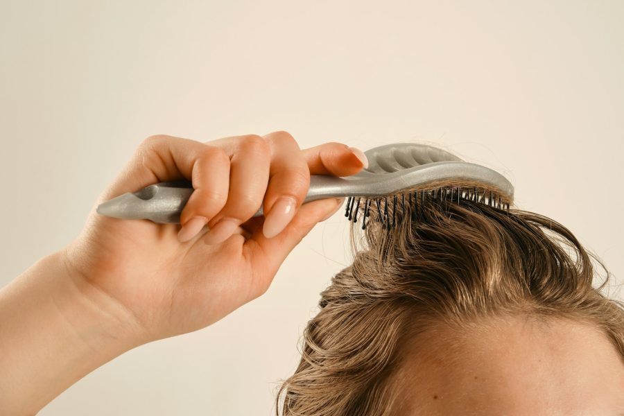 SMP Before a Hair Transplant: Placement, Hairline Design, and Density