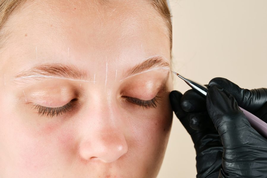 Planning a Hair Transplant Eyebrows Procedure After Trauma Scars