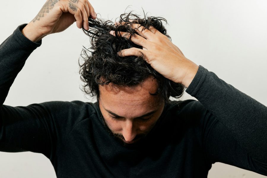 Rebuilding Confidence with Male Hair Transplant After Sudden Hair Loss