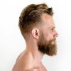 When Beard Hair Implants Make Sense for Diffuse Scalp Thinning