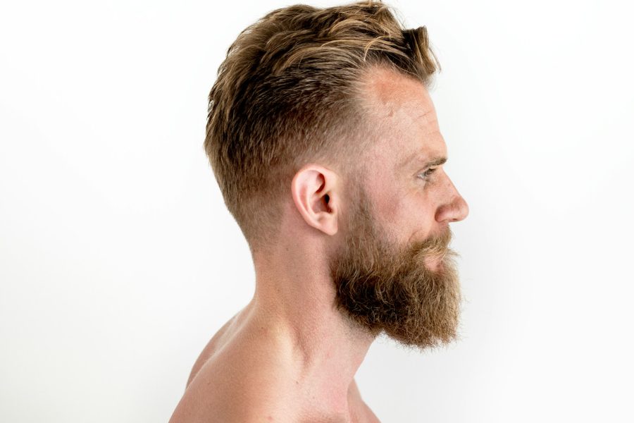 When Beard Hair Implants Make Sense for Diffuse Scalp Thinning