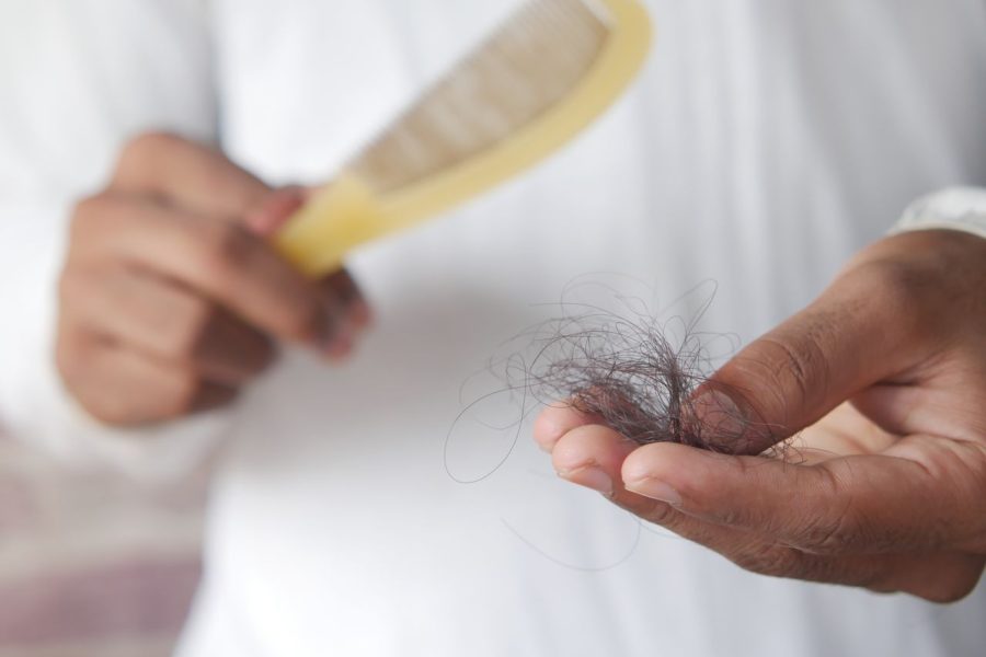 Recognizing Hair Loss Diagnosis Gaps Before Surgery in Toronto