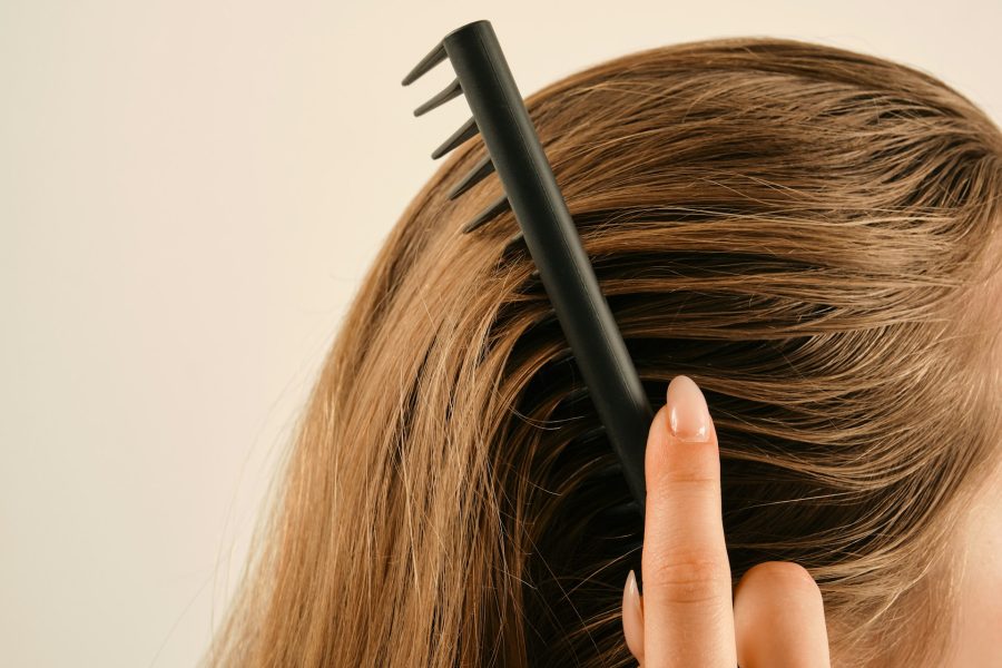 Androgenic Alopecia Solutions After a Treatment Plateau