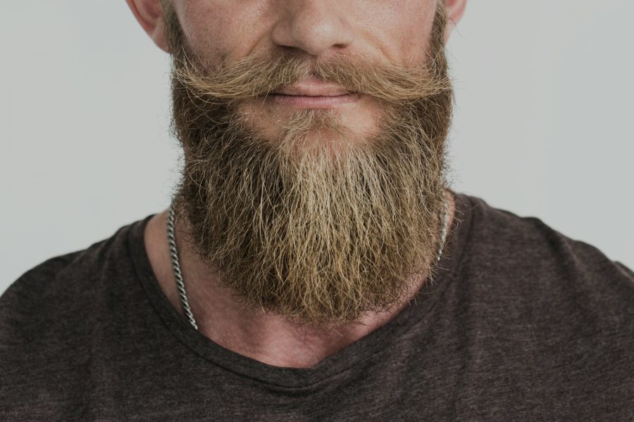 Choosing Beard Hair Implants When Scalp Hair Loss Advances