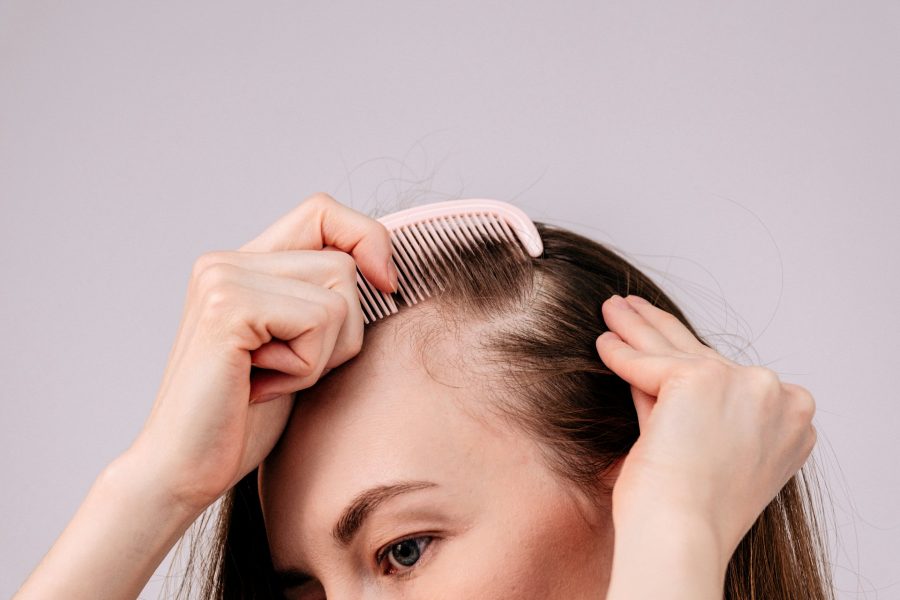 Hairline Lowering Toronto: How Facial Proportions Guide Plans