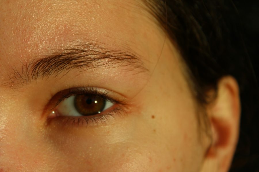 Hidden Hair Loss: When Eyebrow Thinning Signals a Bigger Issue