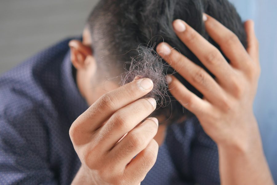 Seasonal Scalp Treatment for Hair Growth in Toronto Athletes