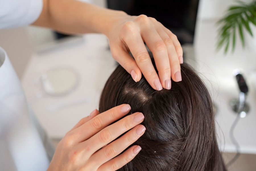 Before Hair Colouring, a Scalp Analysis Procedure Can Help